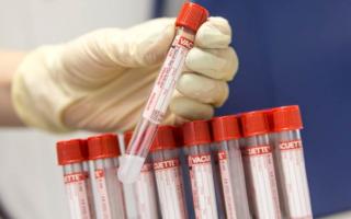 Анализ крови СА 125 – подготовка, значение, расшифровка