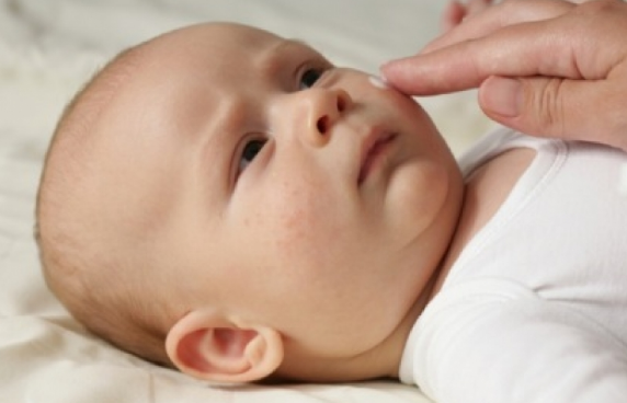 Гормональная сыпь у новорожденных детей