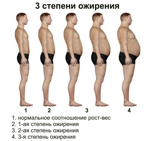 Ожирение у мужчин