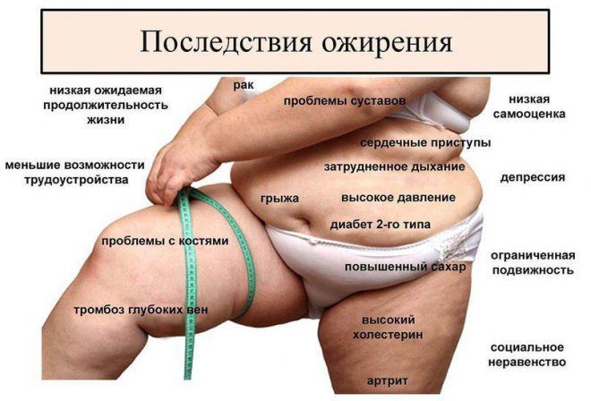 Ожирение у женщин