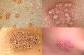 Заболевания кожи и слизистых оболочек
