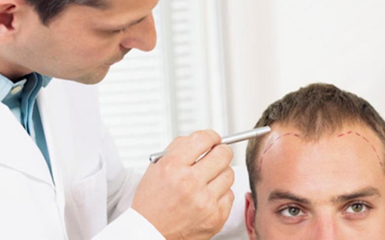 Выпадение волос в лобковой зоне, в подмышечных впадинах и на лице у мужчин